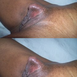 erect clit xxx pic