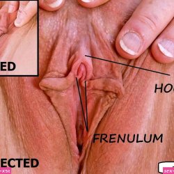 erect clit xxx pic