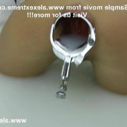 openanal