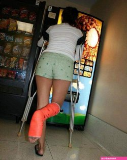 leg cast fetish porn