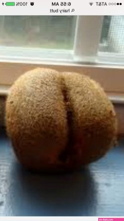 Do women really have hairy buttholes?