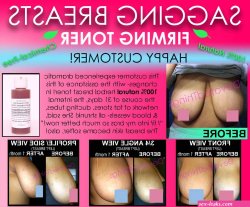 4 Before and After Natural Breast Lift Saggy Breasts Skin Tightening Firmer Tone