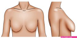 Sagging Breasts: How to Fix Sagging Breasts?