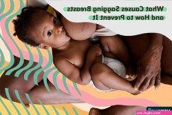 Causes and Prevention of Sagging Breasts