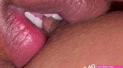 - Nipple Biting and Sucking