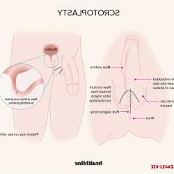 clitoris pictures before and after testosterone