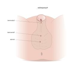 clitoris pictures before and after testosterone