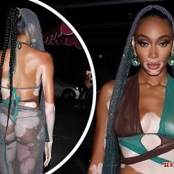 winnie harlow nuda