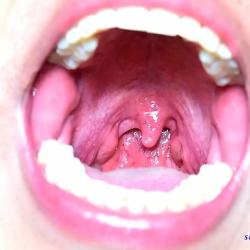 uvula fetish
