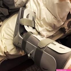 leg cast fetish porn